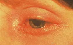 Allergy Library