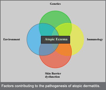 Factors contributing to the pathogenesis of atopic dermatitis